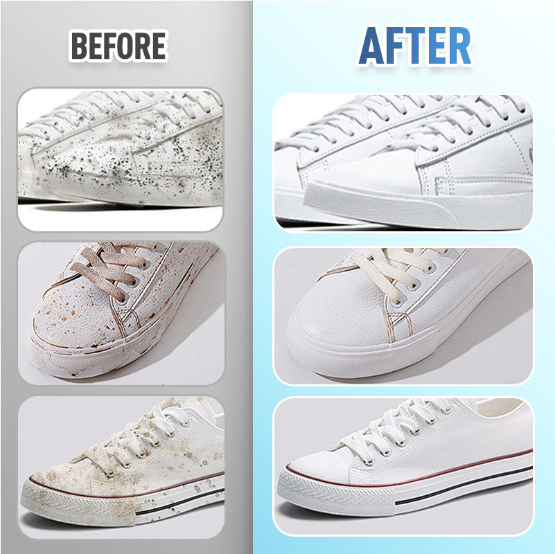 🔥New Hot Selling❤️🔥 Quick-Clean Shoe Wipes