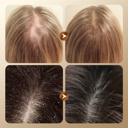 Herbal Hair Loss Prevention and Hair Growth Shampoo🌿